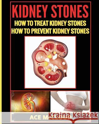Kidney Stones: How To Treat Kidney Stones: How To Prevent Kidney Stones McCloud, Ace 9781640481718