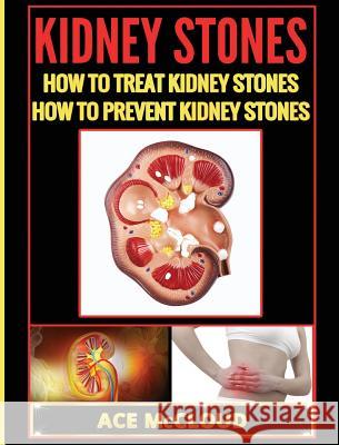 Kidney Stones: How To Treat Kidney Stones: How To Prevent Kidney Stones McCloud, Ace 9781640482968 Pro Mastery Publishing