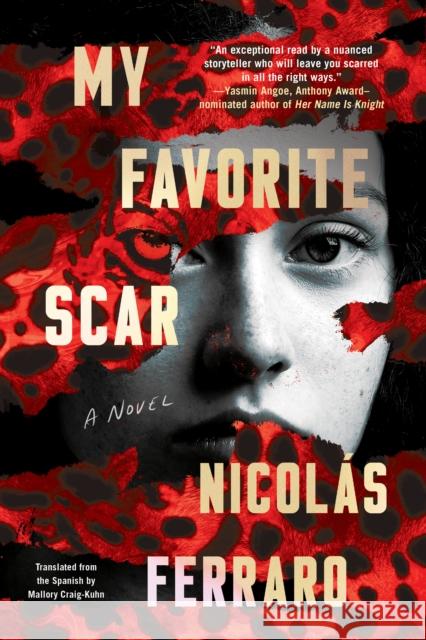 My Favorite Scar Nicol?s Ferraro Mallory Craig-Kuhn 9781641296212 Soho Crime