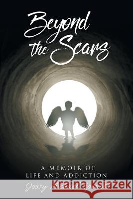 Beyond the Scars: A Memoir of Life and Addiction Jessy Michael Spruell   9781644627129 Page Publishing, Inc.