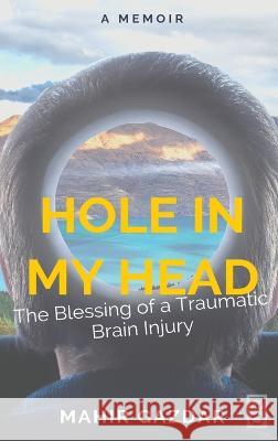 Hole in My Head: The Blessing of a Traumatic Brain Injury Mahir Gazdar   9781645042549