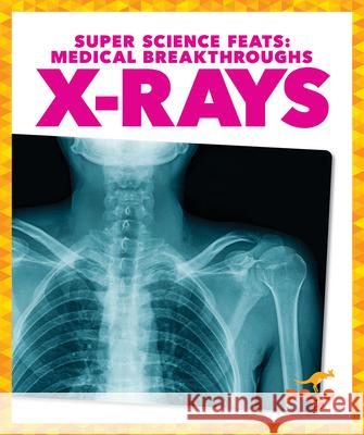 X-Rays Alicia Z. Klepeis 9781645278047 Pogo Books