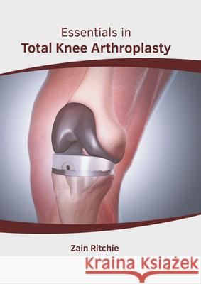 Essentials in Total Knee Arthroplasty Zain Ritchie 9781646461462 Foster Academics