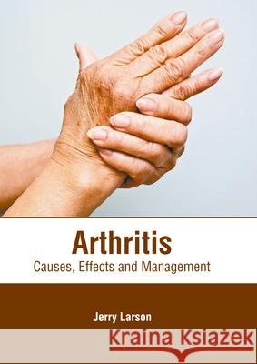 Arthritis: Causes, Effects and Management Jerry Larson 9781646471003