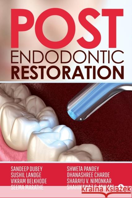 Post Endodontic Restoration Sandeep Dubey, Sushil Landge, Others 9781646507504 Independently Published