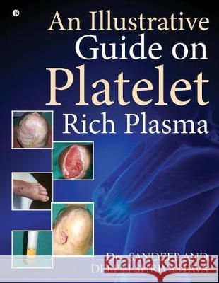 An Illustrative Guide on Platelet Rich Plasma Dr Sandeep                               Dr Deepti Shrivastava 9781646786114