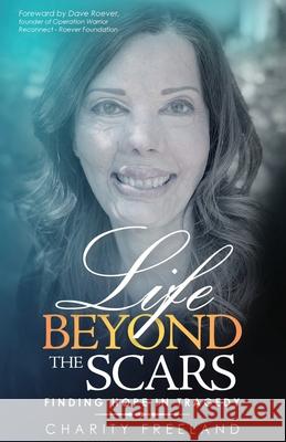 Life Beyond the Scars: Finding Hope in Tragedy Charity Freeland Dave Roever 9781647468644 Author Academy Elite