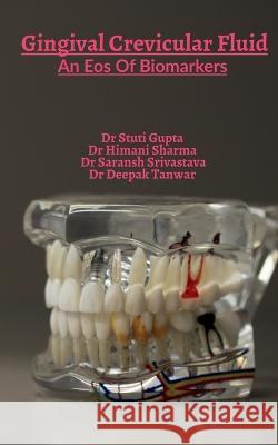 Gingival Crevicular Fluid Stuti Gupta 9781649194602 Notion Press