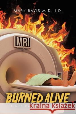 Burned Alive: A Medical Legal Thriller Mark Ravi 9781665772877 Archway Publishing