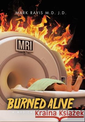 Burned Alive: A Medical Legal Thriller Mark Ravi 9781665772891 Archway Publishing