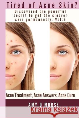 TIRED OF ACNE SKIN? Discover the Powerful Secrets to get Clearer Skin Permanently Amy D. Morse 9781672429436 Independently Published