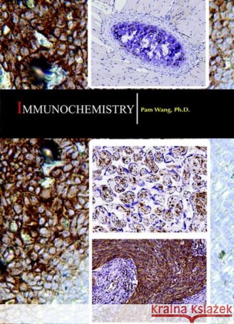 Immunochemistry Pam Wang 9781680959000 Eurospan (JL)