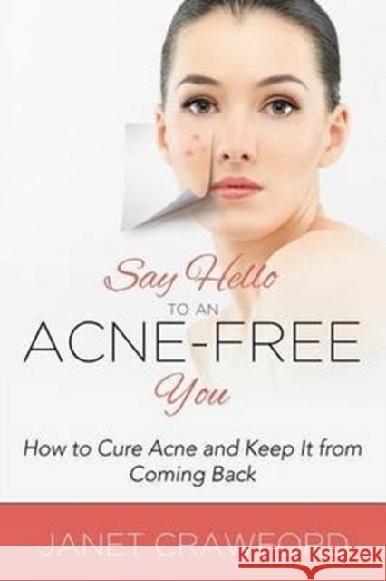 Say Hello to an Acne-Free You: How to Cure Acne and Keep It from Coming Back Janet Crawford 9781681275123 Speedy Publishing LLC