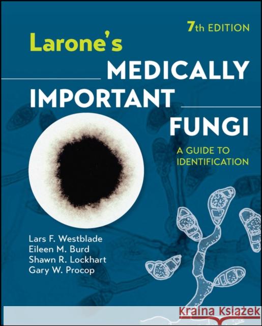 Larone's Medically Important Fungi: A Guide to Ide ntification, 7th Edition Westblade 9781683674405 ASM Press