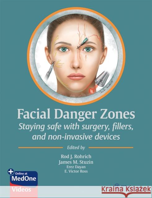 Facial Danger Zones: Staying Safe with Surgery, Fillers, and Non-Invasive Devices Rohrich, Rod J. 9781684200030 Thieme Medical Publishers