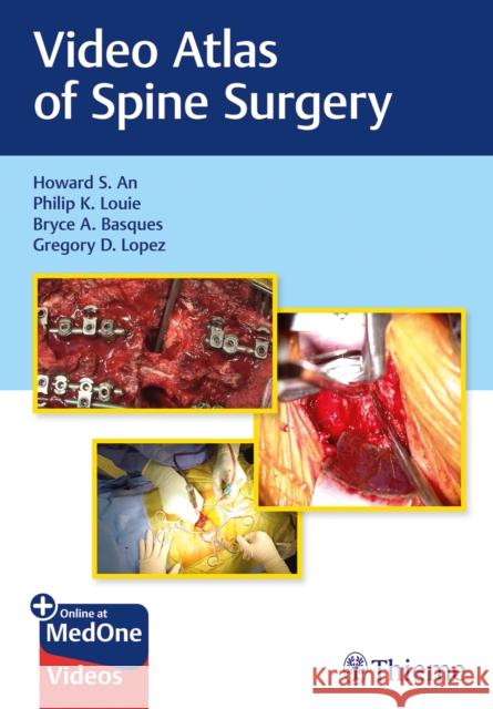 Video Atlas of Spine Surgery An, Howard S. 9781684200054 Thieme Medical Publishers