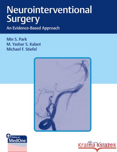 Neurointerventional Surgery: An Evidence-Based Approach Min S. Park M. Yashar Kalani Michael Stiefel 9781684200078 Thieme Medical Publishers