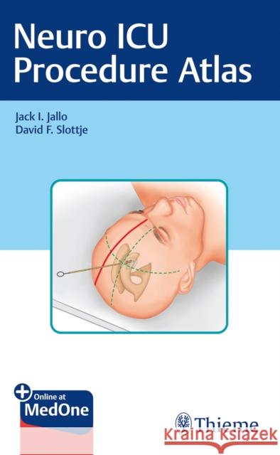 Neuro ICU Procedure Atlas Jack I. Jallo David Slottje 9781684200177 Thieme Medical Publishers