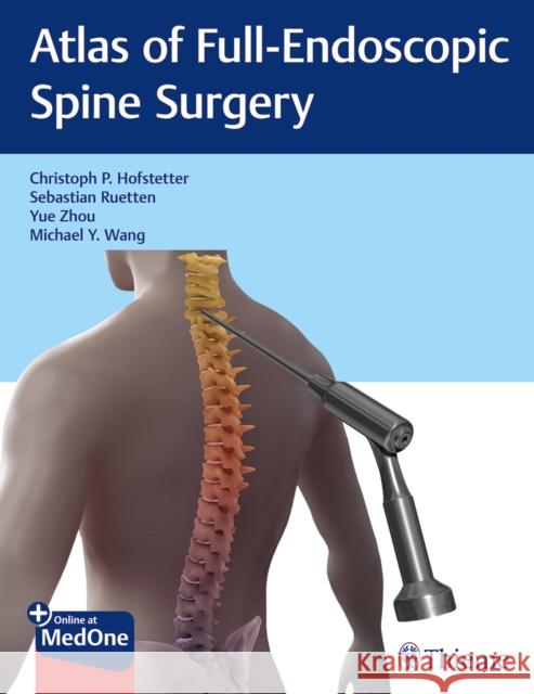 Atlas of Full-Endoscopic Spine Surgery Hofstetter, Christoph 9781684200238 Thieme Medical Publishers