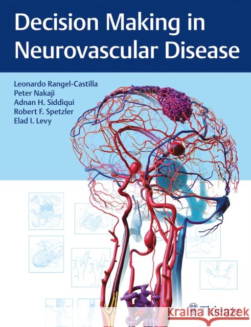 Decision Making in Neurovascular Disease Leonardo Rangel-Castilla Peter Nakaji Adnan Siddiqui 9781684200573 Thieme Medical Publishers