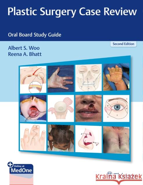 Plastic Surgery Case Review: Oral Board Study Guide Albert S. Woo Reena Bhatt 9781684200627 Thieme Medical Publishers