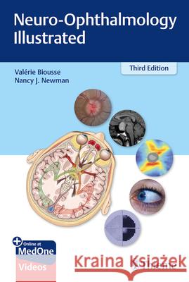 Neuro-Ophthalmology Illustrated : Mit Online-Zugang Valerie Biousse Nancy Newman 9781684200740 