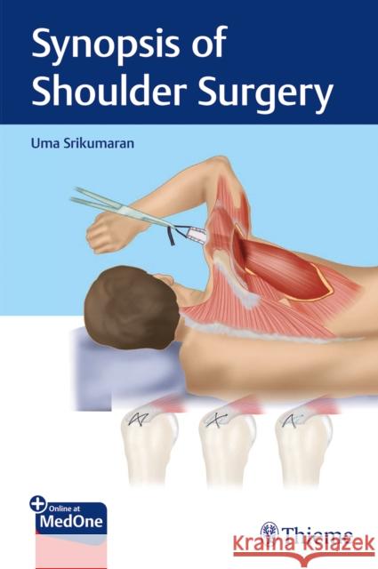 Synopsis of Shoulder Surgery Uma Srikumaran 9781684200801 Thieme Medical Publishers