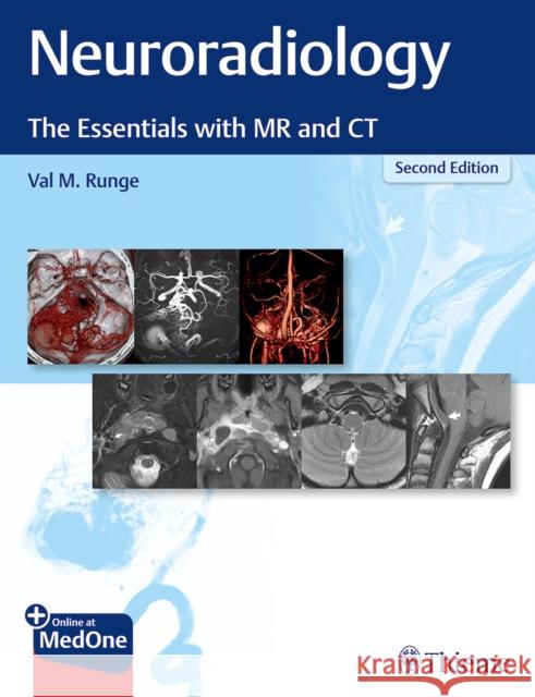 Neuroradiology: The Essentials with MR and CT Val M. Runge 9781684201532 Thieme Medical Publishers