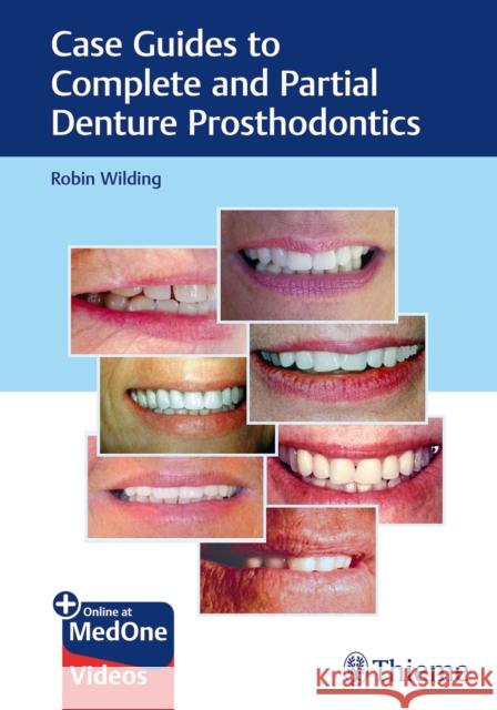 Case Guides to Complete and Partial Denture Prosthodontics : Plus Online at MedOne Videos Robin Wilding 9781684201693 