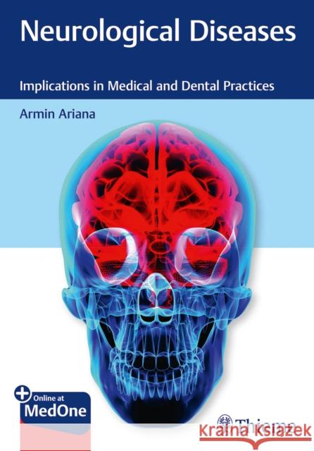 Neurological Diseases: Implications in Medical and Dental Practices Ariana, Armin 9781684202249 Thieme Medical Publishers