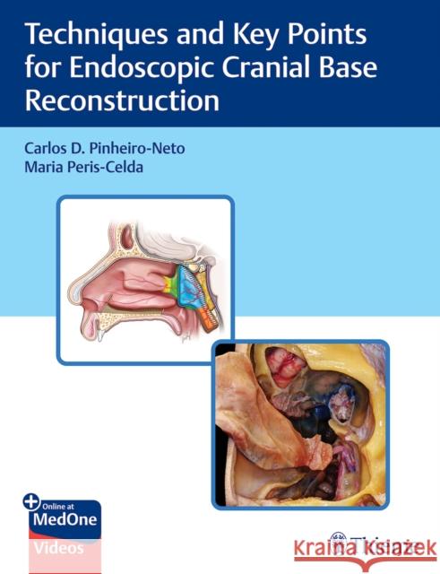 Techniques and Key Points for Endoscopic Cranial Base Reconstruction Carlos Pinheiro-Neto Maria Peris-Celda 9781684202324 Thieme Medical Publishers