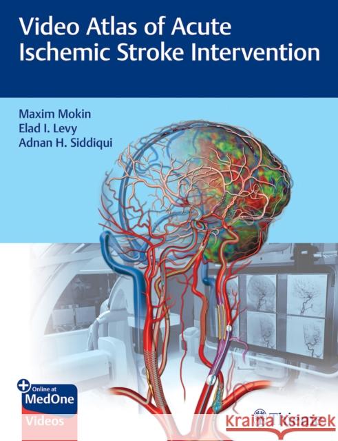 Video Atlas of Acute Ischemic Stroke Intervention Maxim Mokin Elad Levy Adnan Siddiqui 9781684202492 Thieme Medical Publishers