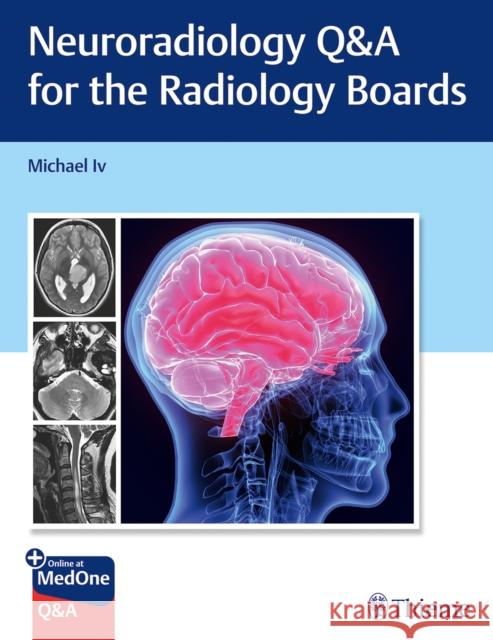 Neuroradiology Q&A for the Radiology Boards Michael Iv 9781684205592 Thieme Medical Publishers Inc