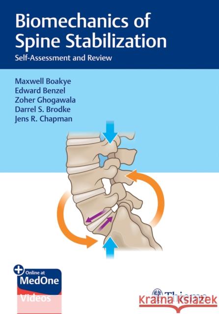 Biomechanics of Spine Stabilization: Self-Assessment and Review Maxwell Boakye Edward Benzel Zoher Ghogawala 9781684205790 Thieme Medical Publishers Inc