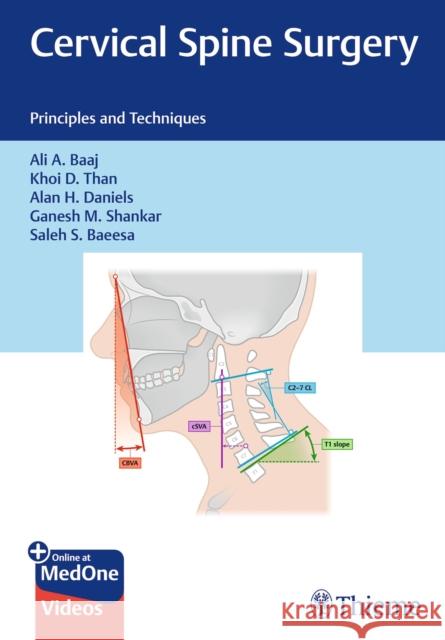 Cervical Spine Surgery: Principles and Techniques Alan H. Daniels 9781684206261
