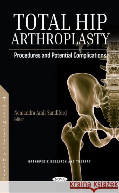 Total Hip Arthroplasty: Procedures and Potential Complications Nemandra Amir Sandiford   9781685071462 Nova Science Publishers Inc