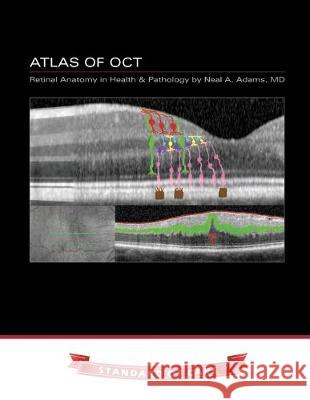 Atlas of OCT: Retinal Anatomy in Health & Pathology Neal Adams 9781687062109 Independently Published