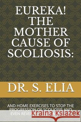 Eureka! the Mother Cause of Scoliosis: And Home Exercises to Stop the Progression of Scoliosis and Even Reverse It! for Ages 1-22 0, H. 9781689024808 Independently Published