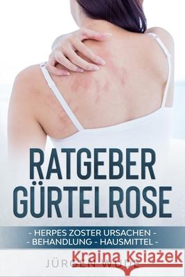 Ratgeber Gürtelrose: Herpes Zoster Ursachen Behandlung Hausmittel Wude, Jürgen 9781712381144