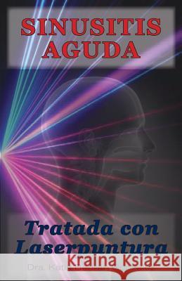 Sinusitis aguda tratada con laserpuntura Bertran Gonzalez, Katia 9781717098047 Createspace Independent Publishing Platform