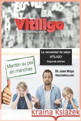 La necesidad de saber VITILIGO: Segunda edición Moya, Jose 9781717852496