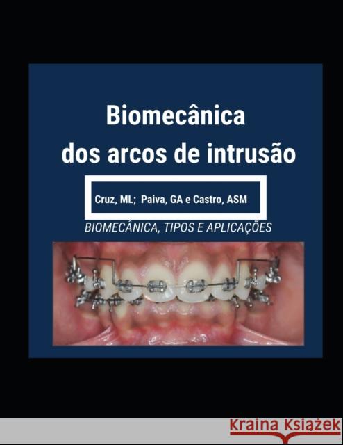 Biomecanica dos Arcos de Intrusao Glauci Paiva Agelita Castro Mirna Liz Cruz 9781718122895