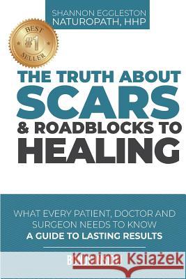 The Truth About Scars and Roadblocks to Healing: What Every Patient, Doctor, and Surgeon Needs to Know Eggleston, Shannon 9781718911239 Createspace Independent Publishing Platform