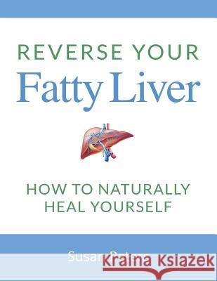 Reverse Your Fatty Liver: How to Naturally Heal Yourself Susan Peters 9781719236638