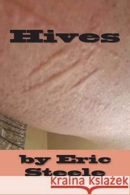 Hives Eric Steele 9781719291606 Createspace Independent Publishing Platform