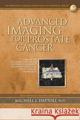 Advanced Imaging for Prostate Cancer: A Primer on 3D Color-Flow Power Doppler Ultrasound, Multiparametric MRI and CT Fusion Techniques Michael J. Dattol 9781720101550 Independently Published