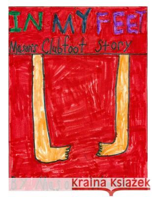 In My Feet: Mason's Clubfoot Story Mason Wienke Mason Wienke 9781721263738 Createspace Independent Publishing Platform