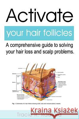 Activate Your Hair Follicles: A Comprehensive Guide to Solving Your Hair Loss and Scalp Problems Beverly Crockett Carol Turner Maisha Barnett 9781724114624