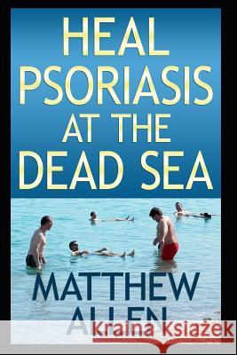Heal Psoriasis at the Dead Sea: Nutrition, Sun, Sea, Detox and Positive Thoughts Essential for Clearing Skin and Joints. Matthew Allen 9781724187888 Independently Published