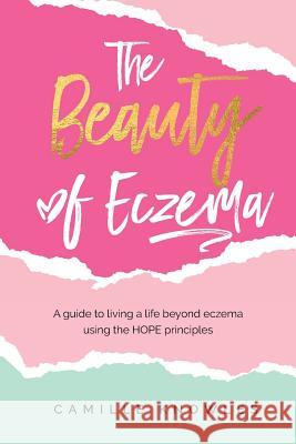 The Beauty of Eczema: A Guide To Living a Life Beyond Eczema Using The Hope Principles Knowles, Camille 9781725619302